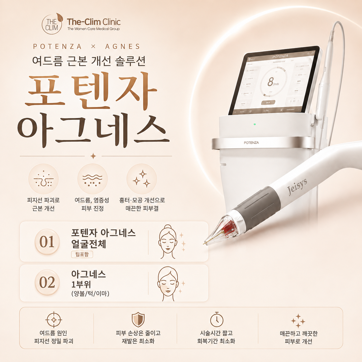 아그네스